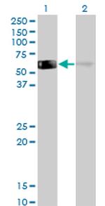 GDI1 Antibody in Western Blot (WB)