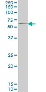 GGT1 Antibody in Western Blot (WB)