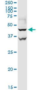 GOT1 Antibody in Western Blot (WB)