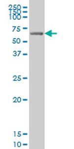 GRK6 Antibody in Western Blot (WB)