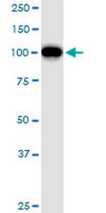 GTF3C2 Antibody in Western Blot (WB)