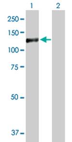 GTF3C2 Antibody in Western Blot (WB)