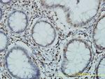 GTF3C2 Antibody in Immunohistochemistry (Paraffin) (IHC (P))