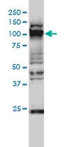 GTF3C2 Antibody in Western Blot (WB)