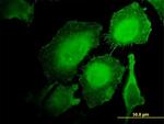 HCLS1 Antibody in Immunocytochemistry (ICC/IF)