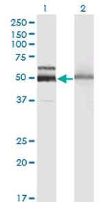 HEXA Antibody in Western Blot (WB)