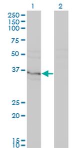 HHEX Antibody in Western Blot (WB)