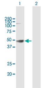 HLA-A Antibody in Western Blot (WB)