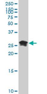 HMGB2 Antibody in Western Blot (WB)