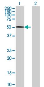 FOXA2 Antibody in Western Blot (WB)