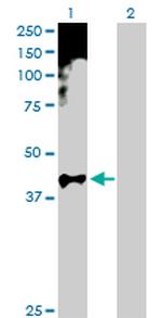 HOXA11 Antibody in Western Blot (WB)