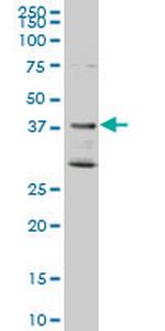 DNAJB2 Antibody in Western Blot (WB)