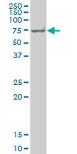 HSPA1B Antibody in Western Blot (WB)