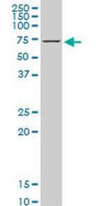 HSPA1B Antibody in Western Blot (WB)