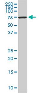 HSPA1L Antibody in Western Blot (WB)