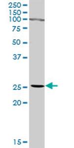 IFNA2 Antibody in Western Blot (WB)