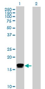 IFNA2 Antibody in Western Blot (WB)