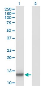 IL2 Antibody in Western Blot (WB)