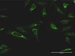 IMPDH2 Antibody in Immunocytochemistry (ICC/IF)