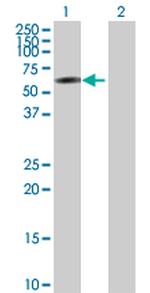 IRF2 Antibody in Western Blot (WB)