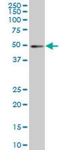 IRF2 Antibody in Western Blot (WB)