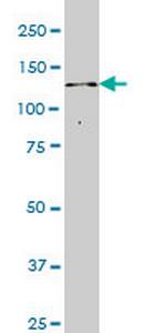 ITPKB Antibody in Western Blot (WB)