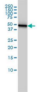 KRT18 Antibody in Western Blot (WB)