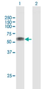 LTBR Antibody in Western Blot (WB)