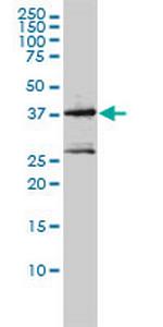 MAGEA2 Antibody in Western Blot (WB)