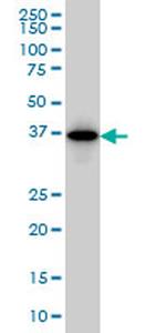 MAGEA9 Antibody in Western Blot (WB)