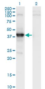 MAGEA11 Antibody in Western Blot (WB)