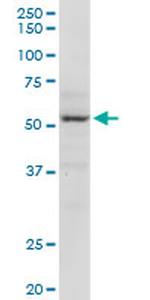 MECP2 Antibody in Western Blot (WB)
