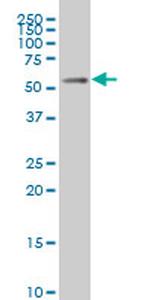 MEIS2 Antibody in Western Blot (WB)