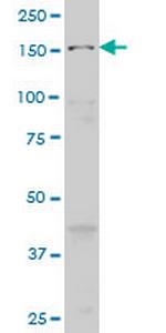 MAP3K5 Antibody in Western Blot (WB)