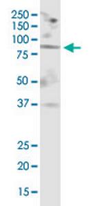 MGAT5 Antibody in Western Blot (WB)