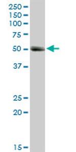 MMP1 Antibody in Western Blot (WB)