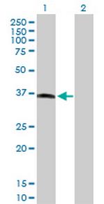 MOS Antibody in Western Blot (WB)