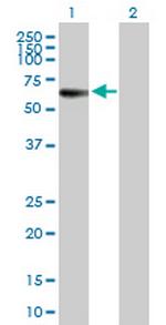 MPP1 Antibody in Western Blot (WB)