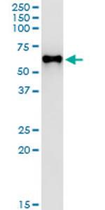 MPP1 Antibody in Immunoprecipitation (IP)