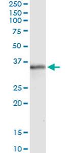 MSX1 Antibody in Immunoprecipitation (IP)