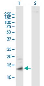 MT1A Antibody in Western Blot (WB)