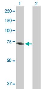 MTHFR Antibody in Western Blot (WB)