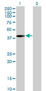 MVK Antibody in Western Blot (WB)