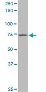 MX1 Antibody in Western Blot (WB)