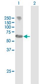 MYCN Antibody in Western Blot (WB)