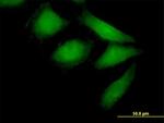 NEDD9 Antibody in Immunocytochemistry (ICC/IF)