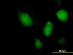 NFATC3 Antibody in Immunocytochemistry (ICC/IF)