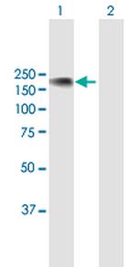 NFATC3 Antibody in Western Blot (WB)