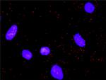 NFKB1 Antibody in Proximity Ligation Assay (PLA) (PLA)