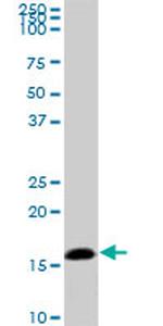 NME2 Antibody in Western Blot (WB)